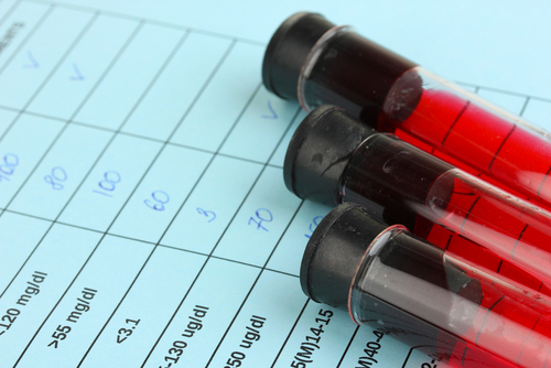 Common ‘Heart Attack’ Blood Test May Predict Future Hypertension